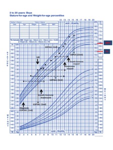 Growth Hormone With Aromatase Inhibitor May Improve Height in